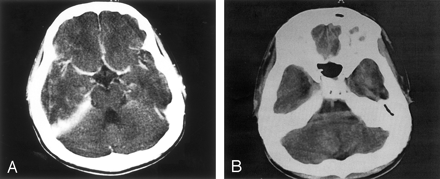 Fig 1.