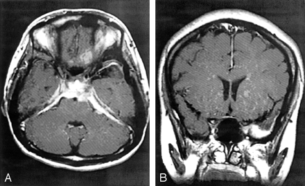 Fig 3.