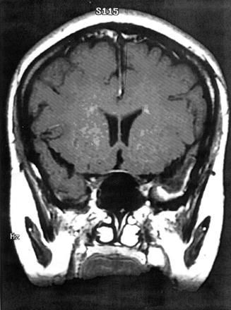 Fig 4.
