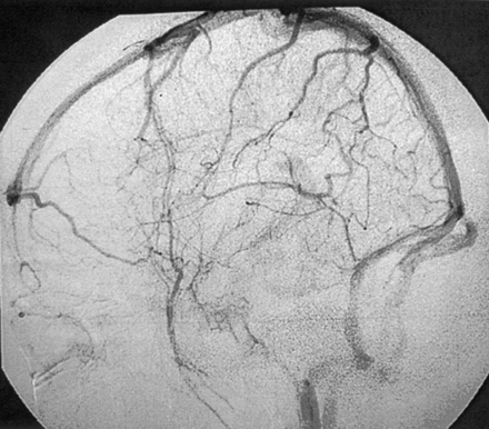 Fig 8.