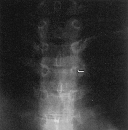 Fig 1.