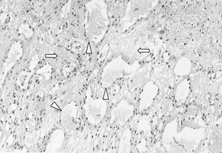 Fig 4.