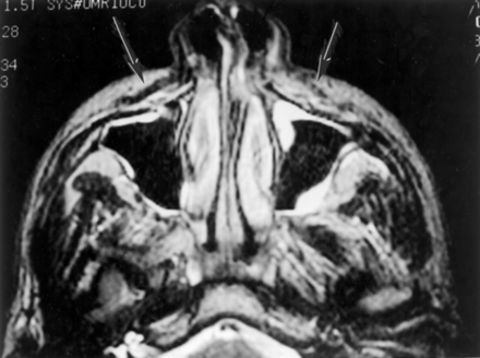Fig 6.