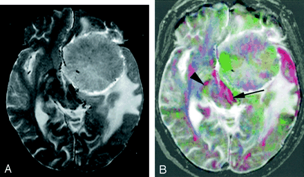 Fig 7.