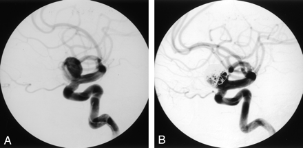 Fig 5.