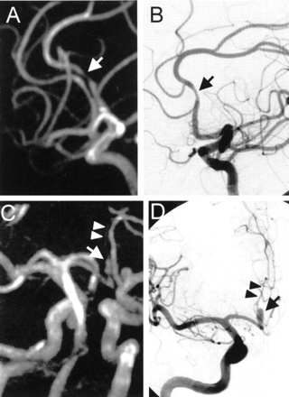 Fig 8.
