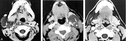 Fig 3.