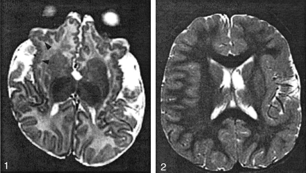 Fig 2.