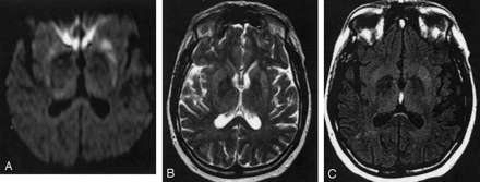 Fig 2.