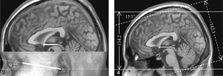 Fig 4.