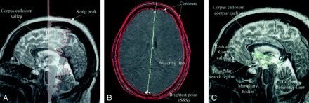 Fig 5.