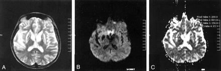 Fig 2.