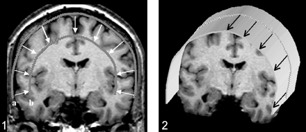 Fig 2.