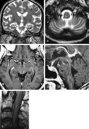 Fig 4.