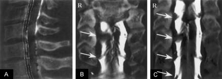 Fig 3.