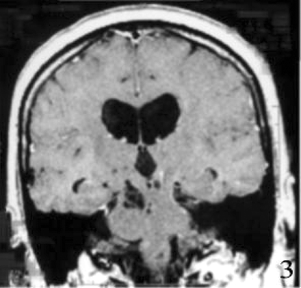Fig 3.