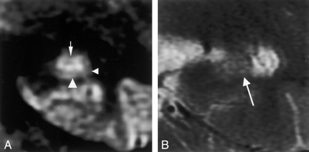 Fig 5.