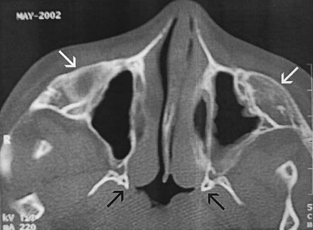 Fig 3.