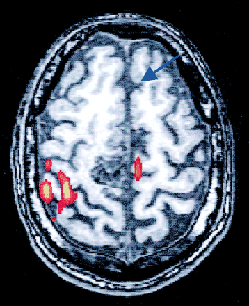 Fig 1.