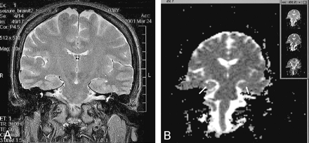 Fig 1.