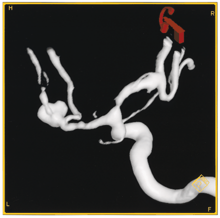 Fig 2.