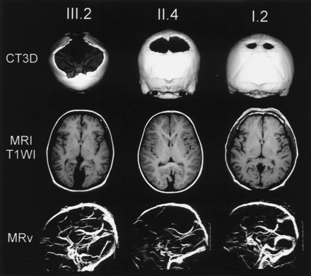 Fig 2.