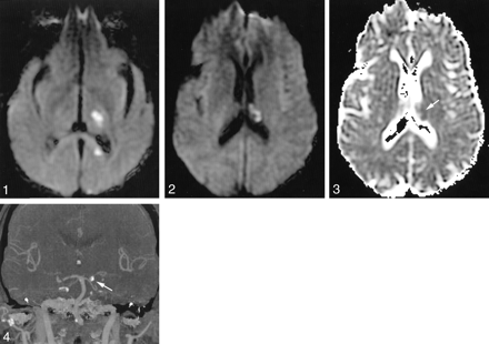 Fig 3.