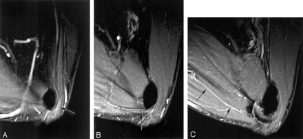 Fig 5.