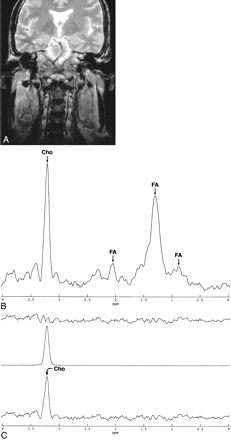 Fig 2.