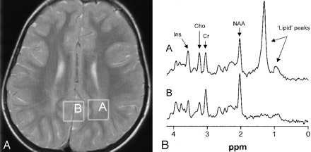 Fig 5.