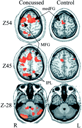 Fig 3.