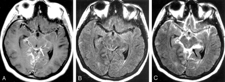 Fig 2.