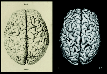 Fig 1.