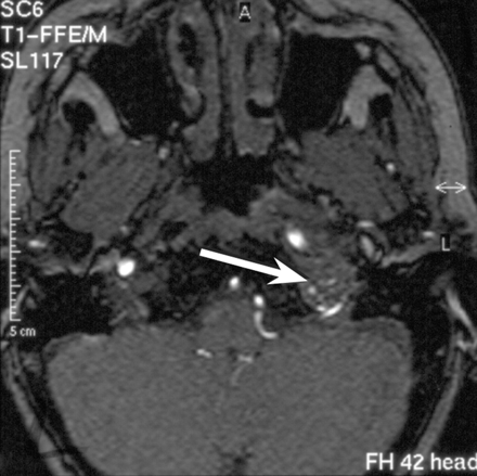 Fig 4.