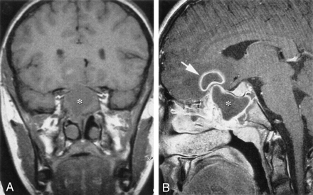 Fig 2.