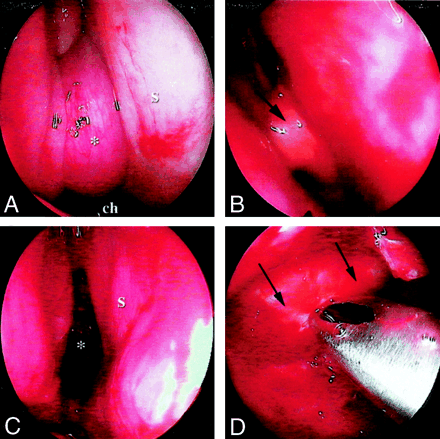 Fig 3.