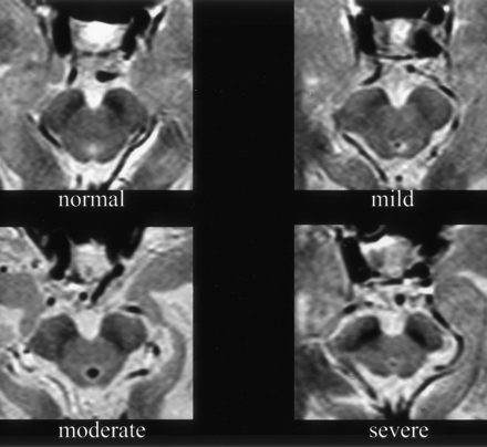 Fig 2.