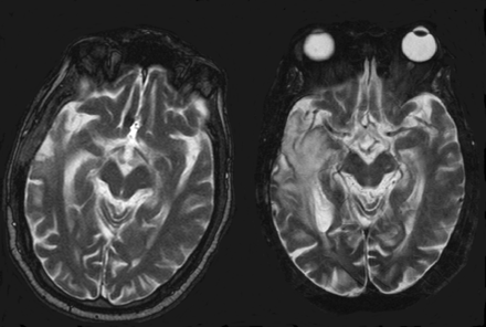 Fig 7.