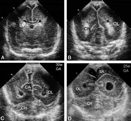 Fig 2.