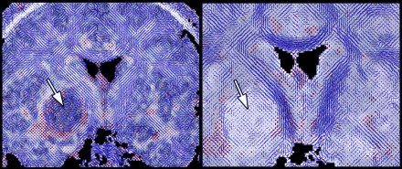 Fig 5.