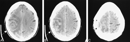 Fig 1.