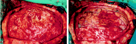 Fig 8.
