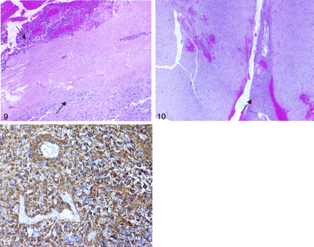 Fig 9.