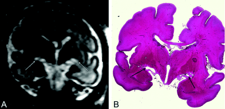 Fig 2.
