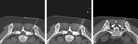 Fig 2.