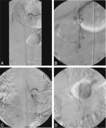 Fig 2.