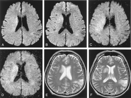 Fig 3.