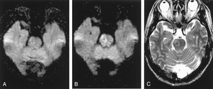 Fig 4.