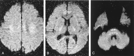 Fig 6.