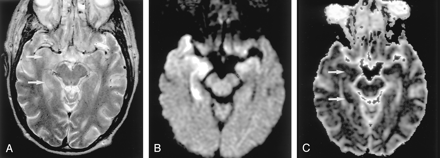 Fig 10.